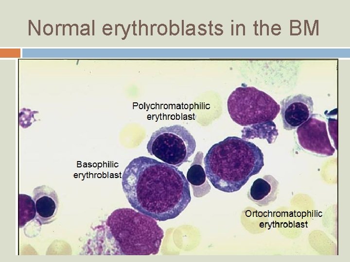 Normal erythroblasts in the BM 