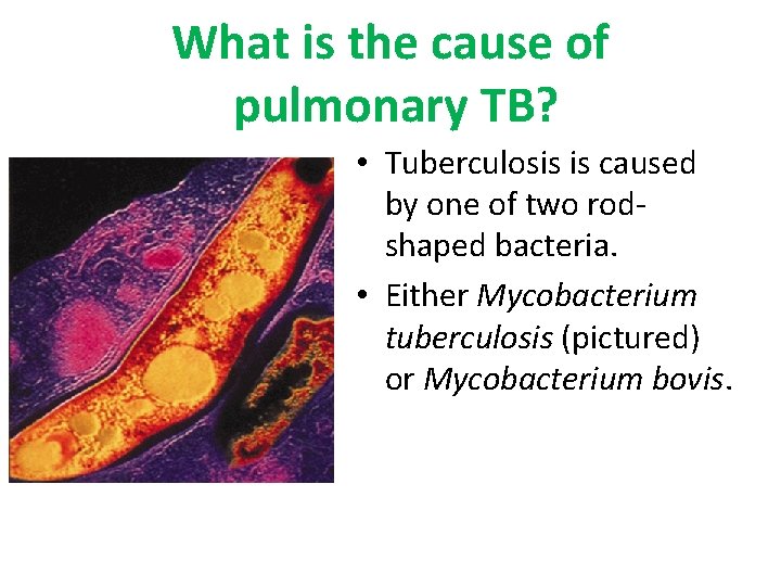 What is the cause of pulmonary TB? • Tuberculosis is caused by one of