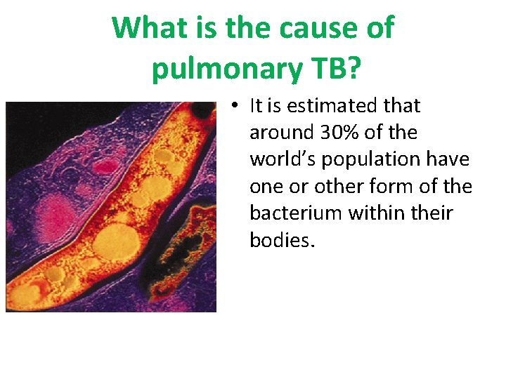 What is the cause of pulmonary TB? • It is estimated that around 30%