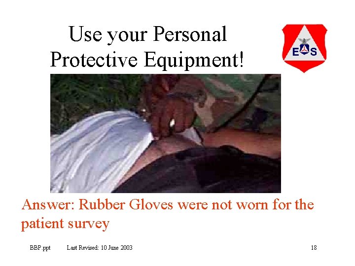Use your Personal Protective Equipment! Answer: Rubber Gloves were not worn for the patient