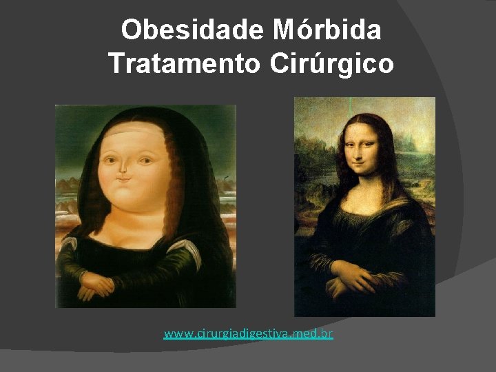 Obesidade Mórbida Tratamento Cirúrgico www. cirurgiadigestiva. med. br 