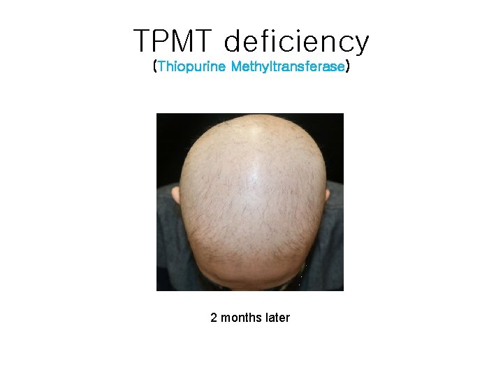 TPMT deficiency (Thiopurine Methyltransferase) 2 months later 