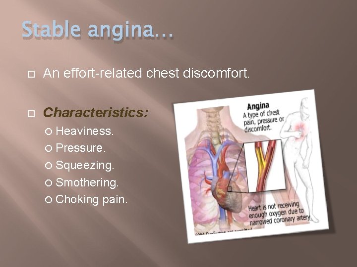 Stable angina… An effort-related chest discomfort. Characteristics: Heaviness. Pressure. Squeezing. Smothering. Choking pain. 