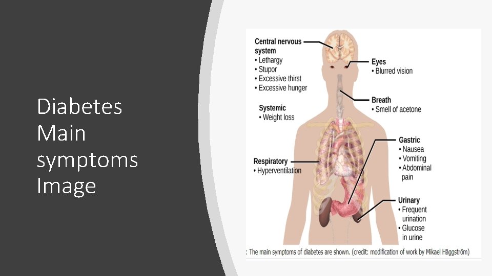 Diabetes Main symptoms Image 