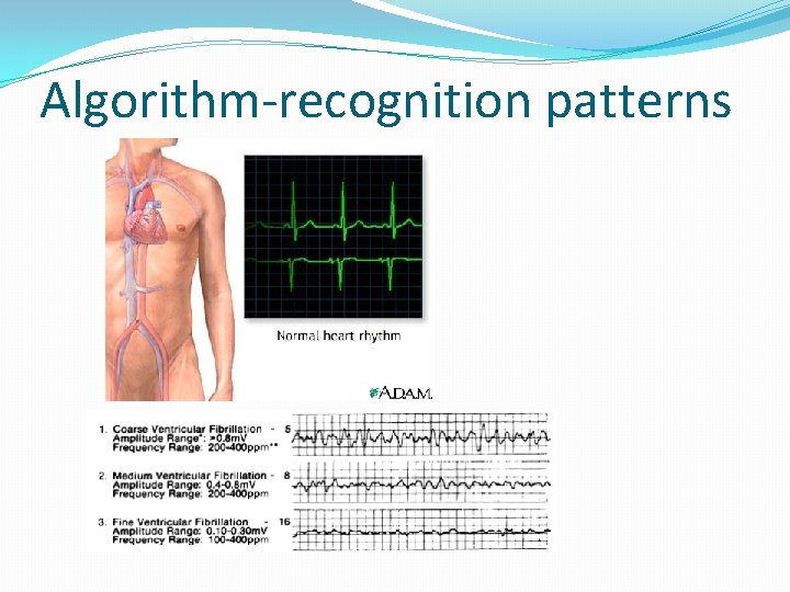 Algorithm-recognition patterns 