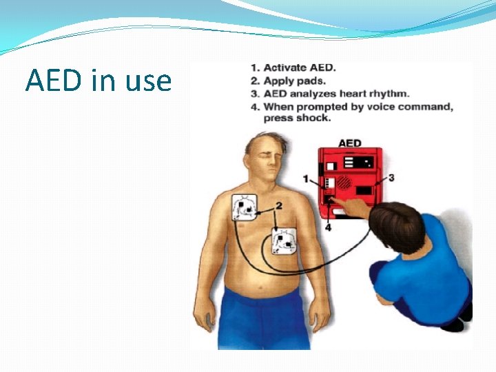 AED in use 