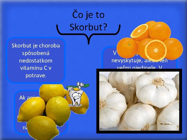 Čo je to Skorbut? Skorbut je choroba spôsobená nedostatkom vitamínu C v potrave. Ak