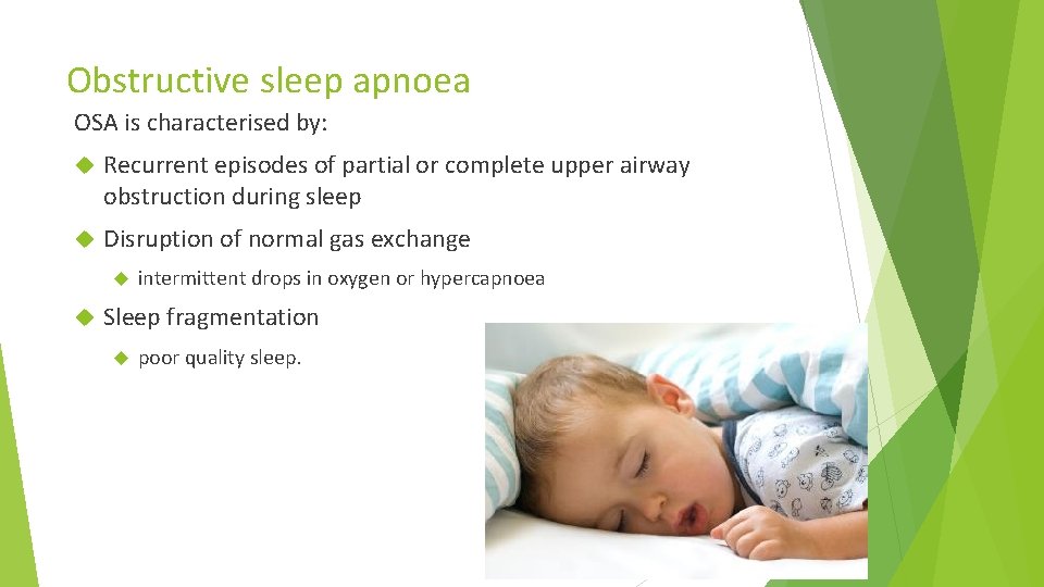 Obstructive sleep apnoea OSA is characterised by: Recurrent episodes of partial or complete upper