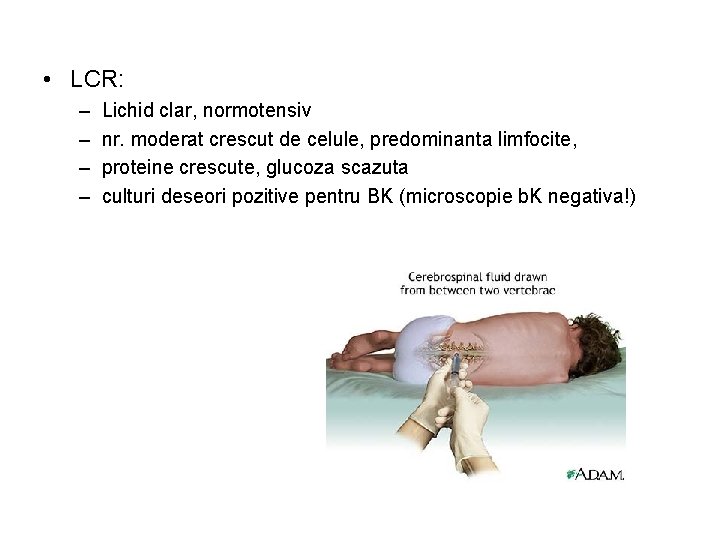  • LCR: – – Lichid clar, normotensiv nr. moderat crescut de celule, predominanta