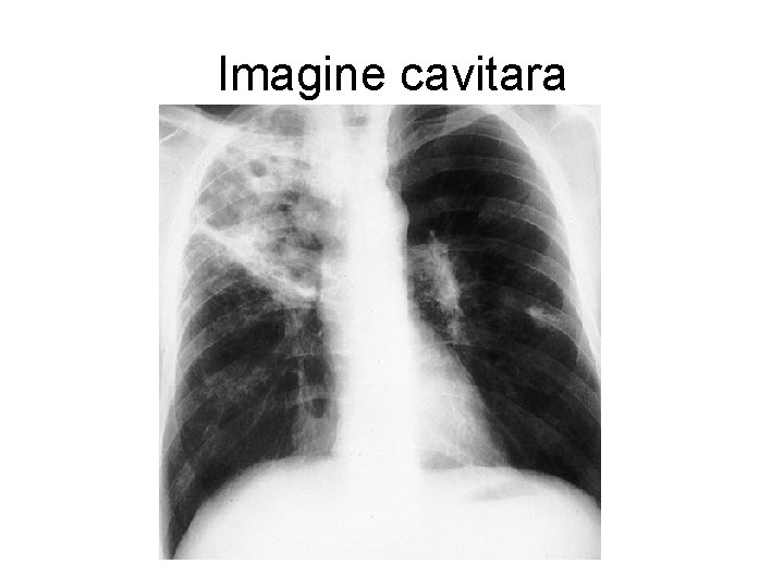 Imagine cavitara 