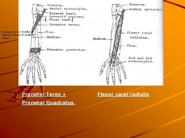 (( ) Impression on middle of lateral surface of shaft of radius Pronator Teres