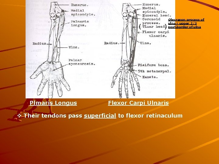 ( Plmaris Longus ) Olecranon process of ulna+ upper 2/3 post. border of ulna