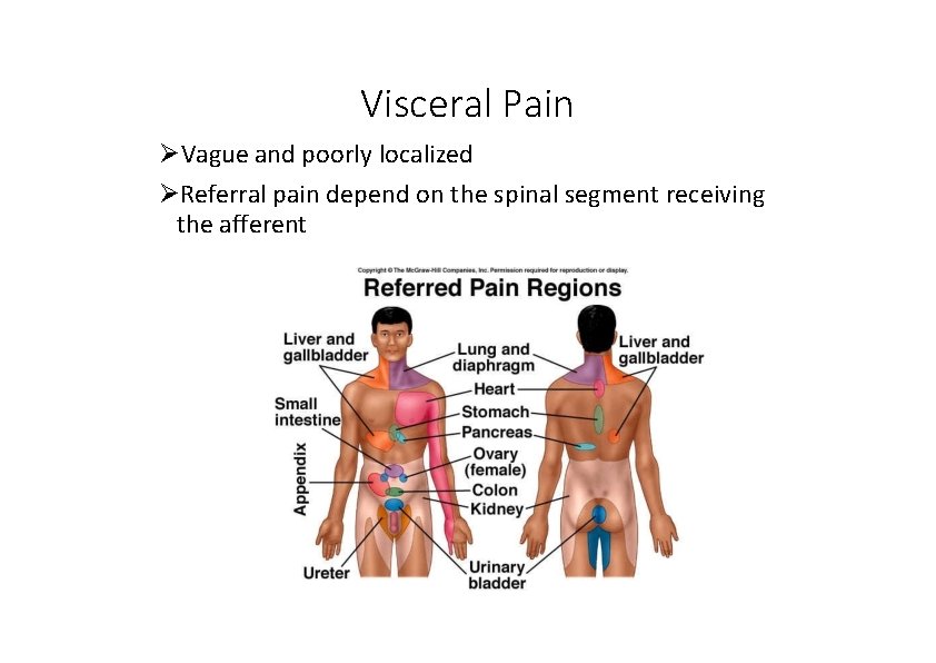 Visceral Pain Vague and poorly localized Referral pain depend on the spinal segment receiving