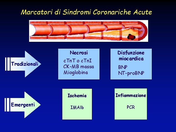 Marcatori di Sindromi Coronariche Acute Necrosi Tradizionali Emergenti c. Tn. T o c. Tn.