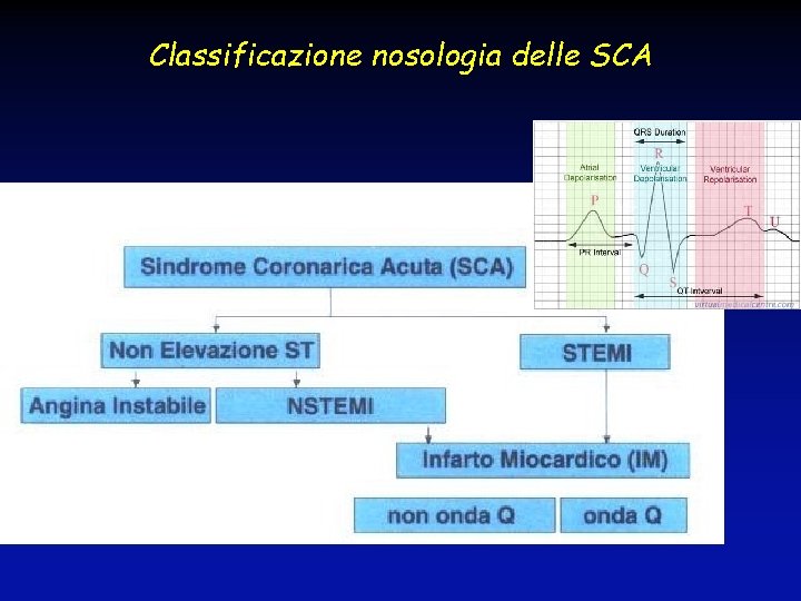 Classificazione nosologia delle SCA 