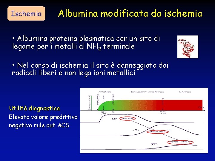 Ischemia Albumina modificata da ischemia • Albumina proteina plasmatica con un sito di legame