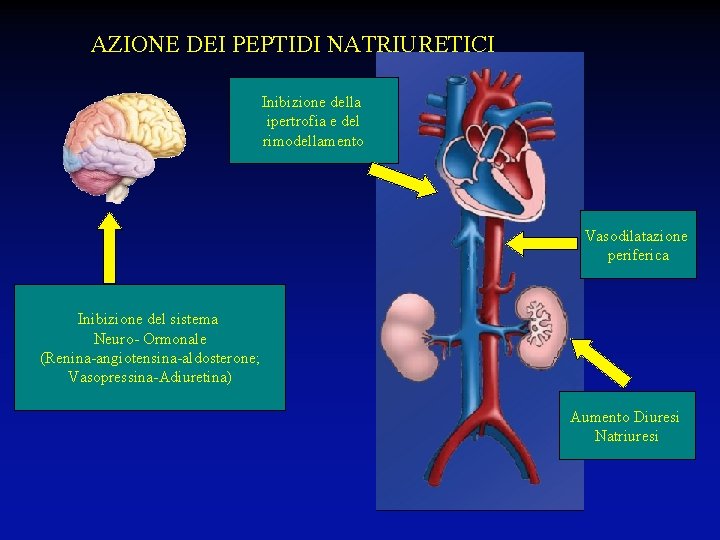 AZIONE DEI PEPTIDI NATRIURETICI Inibizione della ipertrofia e del rimodellamento Vasodilatazione periferica Inibizione del