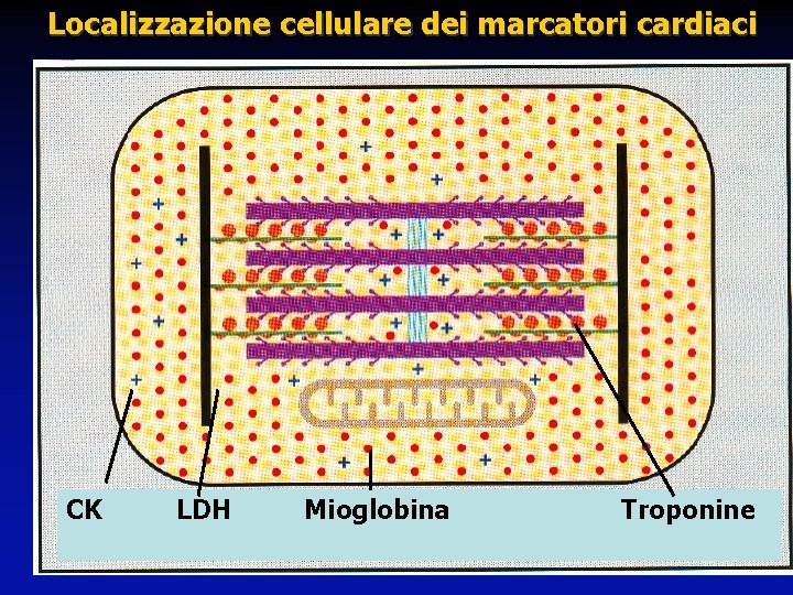 Localizzazione cellulare dei marcatori cardiaci CK LDH Mioglobina Troponine 