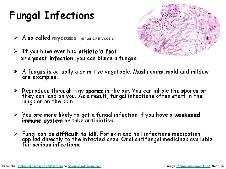 Fungal Infections Ø Also called mycoses (singular mycosis) Ø If you have ever had