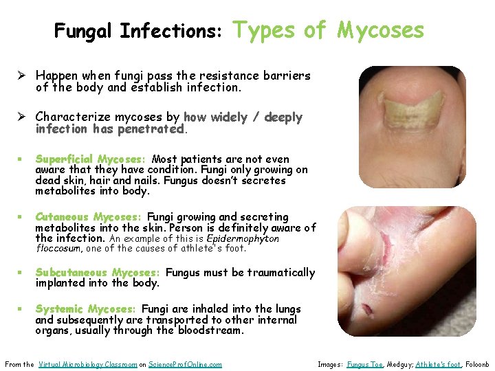 Fungal Infections: Types of Mycoses Ø Happen when fungi pass the resistance barriers of