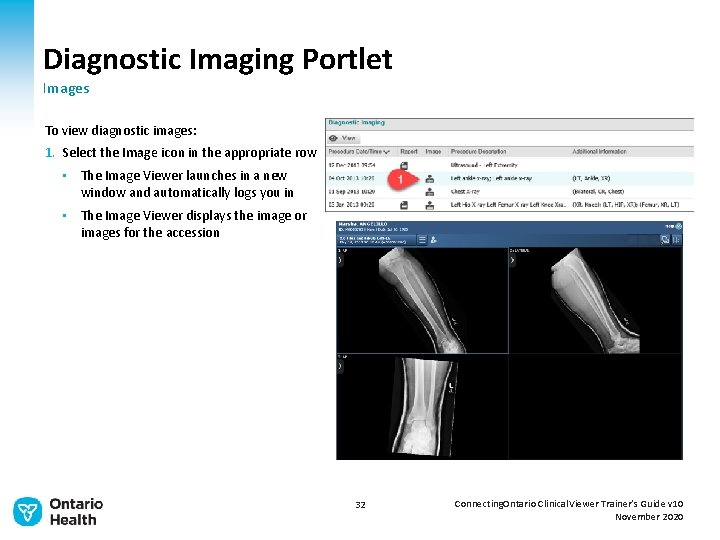 Diagnostic Imaging Portlet Images To view diagnostic images: 1. Select the Image icon in