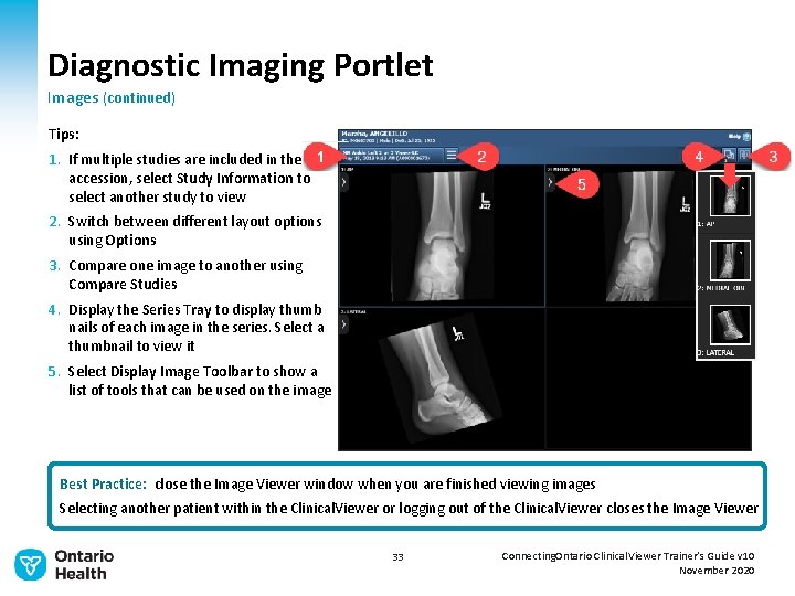 Diagnostic Imaging Portlet Images (continued) Tips: 1. If multiple studies are included in the
