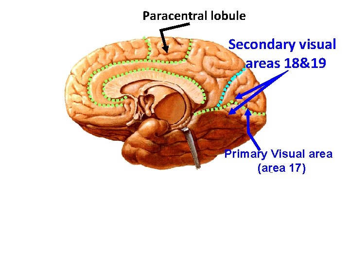 Paracentral lobule Secondary visual areas 18&19 Primary Visual area (area 17) 