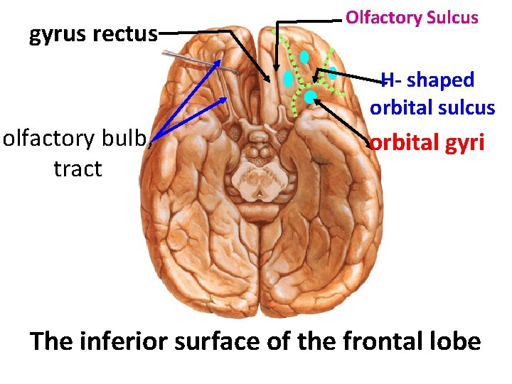 gyrus rectus Olfactory Sulcus H- shaped orbital sulcus olfactory bulb, tract orbital gyri The