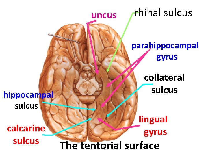 uncus rhinal sulcus parahippocampal gyrus hippocampal sulcus calcarine sulcus collateral sulcus lingual gyrus The