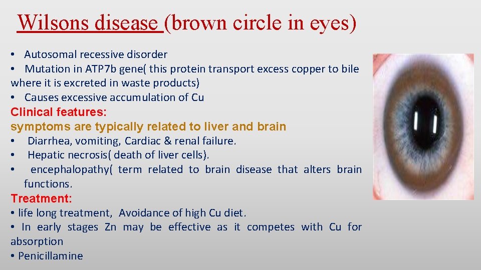 Wilsons disease (brown circle in eyes) • Autosomal recessive disorder • Mutation in ATP