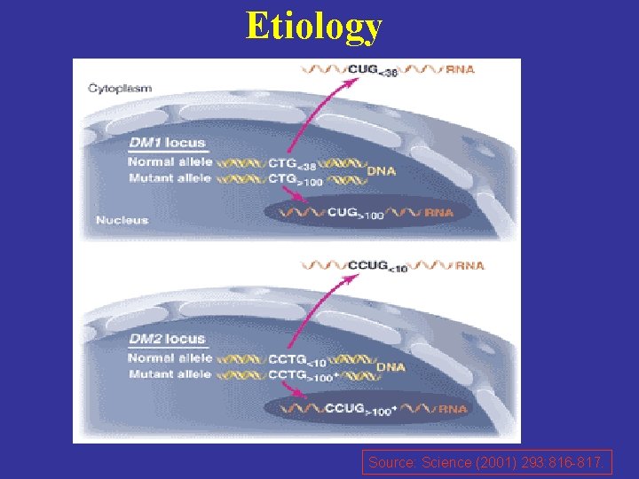 Etiology Source: Science (2001) 293: 816 -817. 