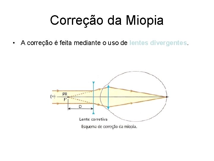 Correção da Miopia • A correção é feita mediante o uso de lentes divergentes.