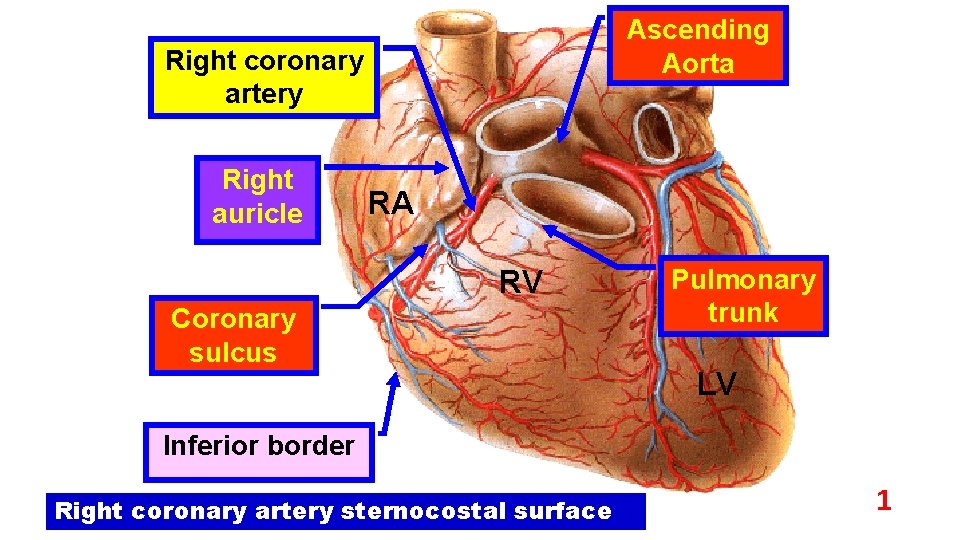 Ascending Aorta Right coronary artery Right auricle RA RV Coronary sulcus Pulmonary trunk LV