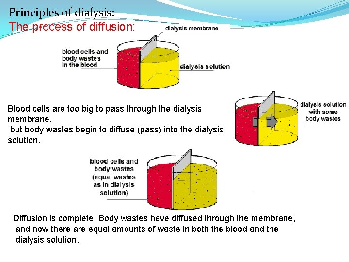 Principles of dialysis: The process of diffusion: Blood cells are too big to pass