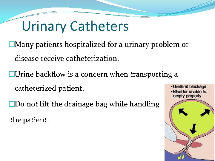 Urinary Catheters �Many patients hospitalized for a urinary problem or disease receive catheterization. �Urine