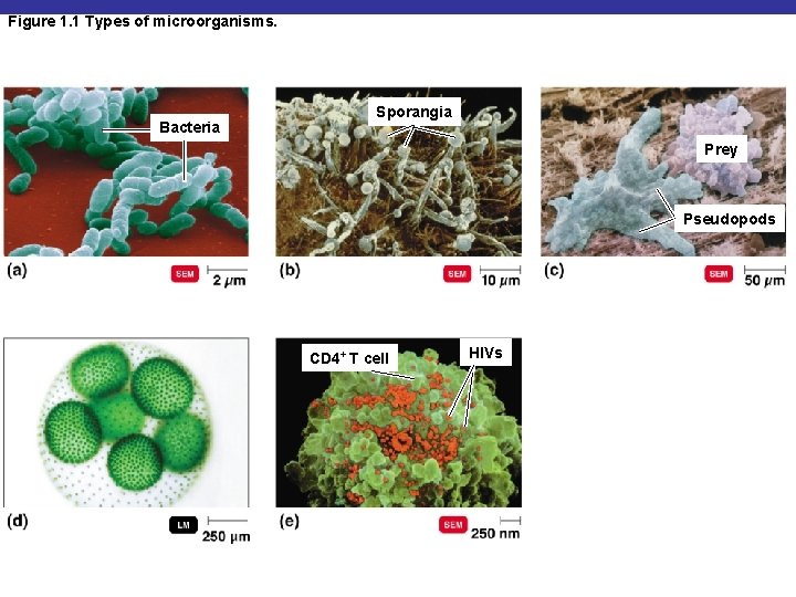 Figure 1. 1 Types of microorganisms. Bacteria Sporangia Prey Pseudopods CD 4+ T cell