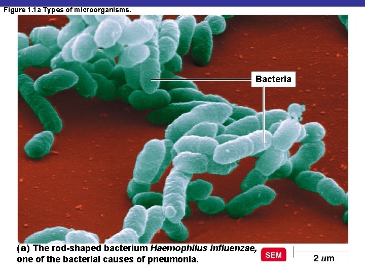 Figure 1. 1 a Types of microorganisms. Bacteria (a) The rod-shaped bacterium Haemophilus influenzae,