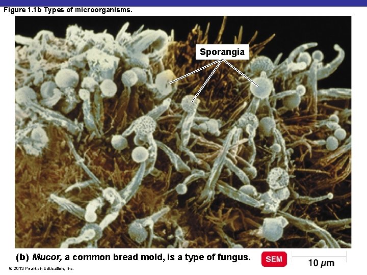 Figure 1. 1 b Types of microorganisms. Sporangia (b) Mucor, a common bread mold,