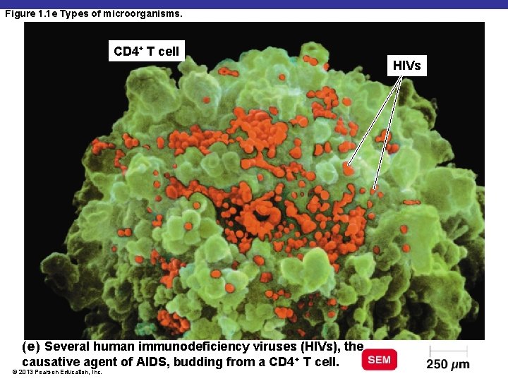 Figure 1. 1 e Types of microorganisms. CD 4+ T cell HIVs (e) Several