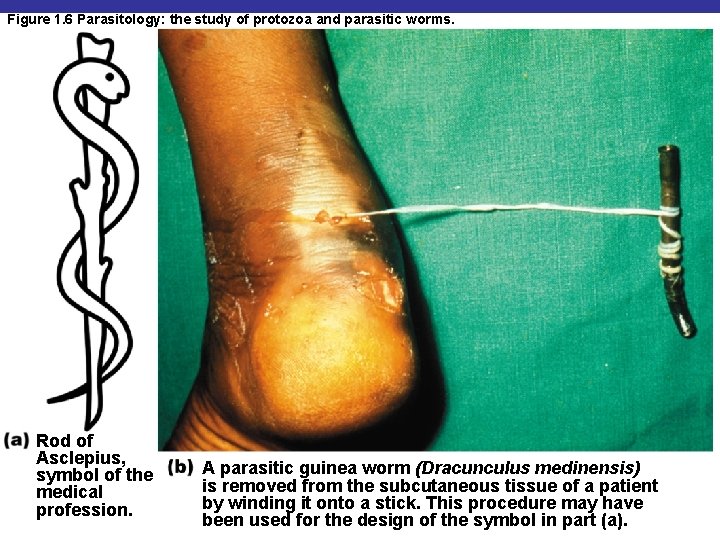 Figure 1. 6 Parasitology: the study of protozoa and parasitic worms. Rod of Asclepius,