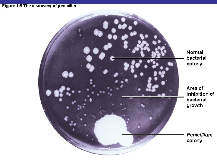 Figure 1. 5 The discovery of penicillin. Normal bacterial colony Area of inhibition of