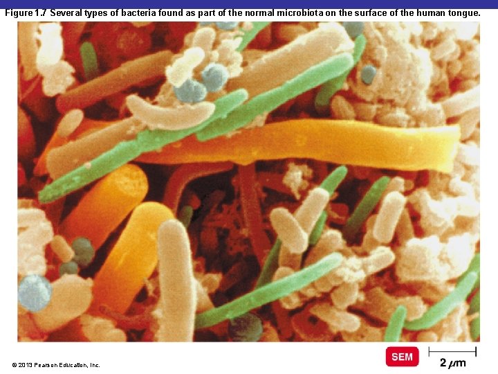 Figure 1. 7 Several types of bacteria found as part of the normal microbiota
