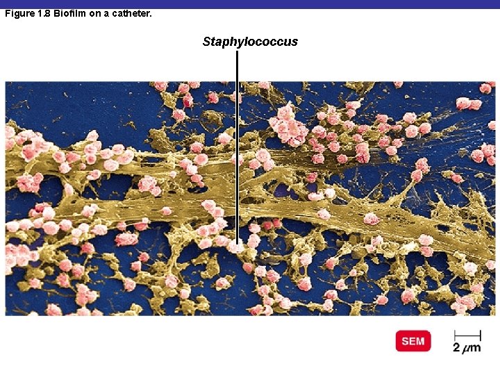 Figure 1. 8 Biofilm on a catheter. Staphylococcus 