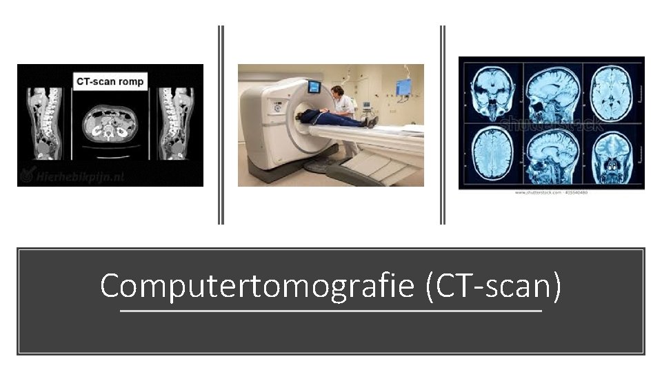 Computertomografie (CT-scan) 