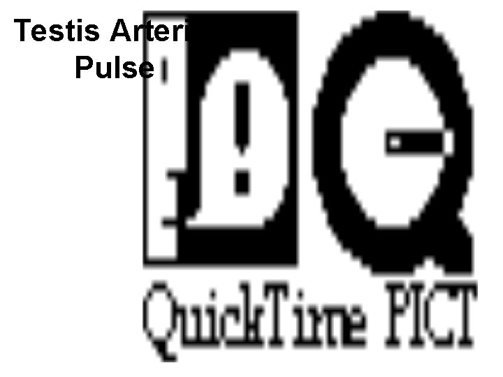 Testis Arterial Pulse 