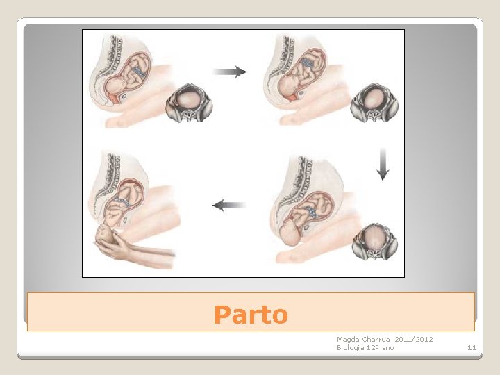 Parto Magda Charrua 2011/2012 Biologia 12º ano 11 