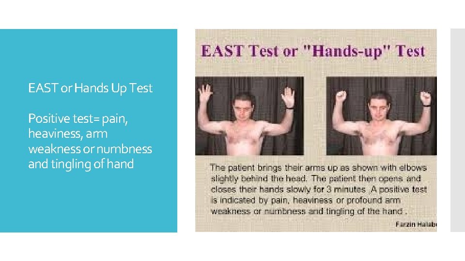 EAST or Hands Up Test Positive test= pain, heaviness, arm weakness or numbness and