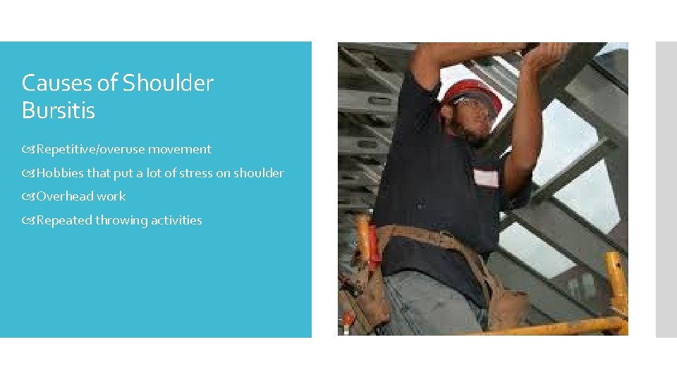Causes of Shoulder Bursitis Repetitive/overuse movement Hobbies that put a lot of stress on