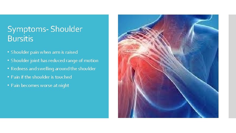 Symptoms- Shoulder Bursitis • Shoulder pain when arm is raised • Shoulder joint has
