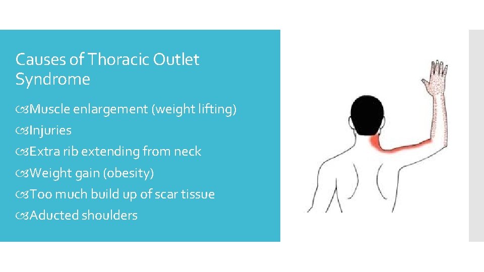 Causes of Thoracic Outlet Syndrome Muscle enlargement (weight lifting) Injuries Extra rib extending from